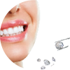 Bild Zahnschmuck